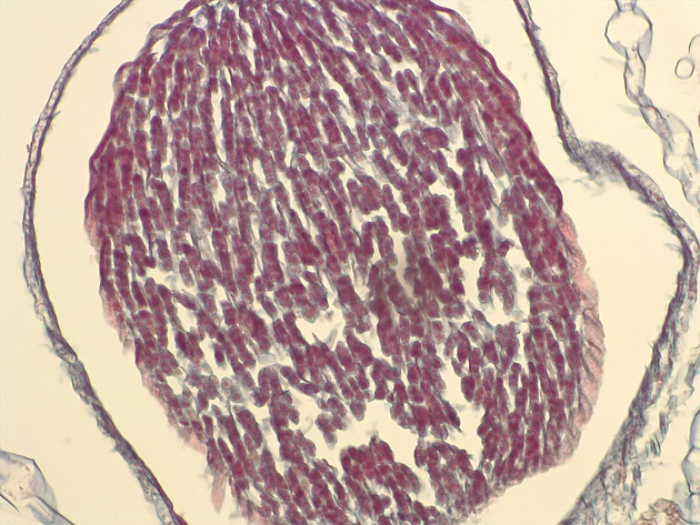 Liverwort Sporophyte Slides - Liverwort Sporophyte 01 200X